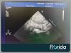 PHILIPS S8-3 SECTOR ARRAY TRANSDUCER PROBE REF 453561270603 TESTED 30 DAYS WARRANTY Ultrasound Transducer