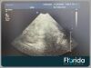PHILIPS S4-1 PHASED ARRAY TRANSDUCER PROBE REF 4000-0966-02 TESTED 30 DAYS WARRANTY Ultrasound Transducer