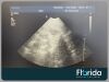 PHILIPS S4-1 PHASED ARRAY TRANSDUCER PROBE REF 4000-0966-02 TESTED 30 DAYS WARRANTY Ultrasound Transducer
