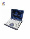 GE Vivid e portable ultrasound Ultrasound - Cardiac - Vascular