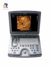GE Voluson e portable ultrasound Ultrasound - OB / GYN