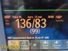 PHILIPS 2010  Intellivue MP30 Anesthesia Patient Monitor