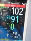 PHILIPS 2010  Intellivue MP30 Anesthesia Patient Monitor