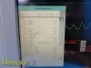 SPACELABS 91370 Ultraview SL Patient Monitor