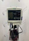 WELCH ALLYN 6200-Series BP Monitor
