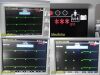 GE HEALTHCARE GE Mac 5500HD ECG Machine W/ CAM-14 Module,IF Cable,Trolley,Battery,Server