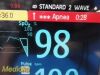 PHILIPS Intellivue MP30, W/ M3001A MMS Module & NEW Leads ~  Patient Monitor