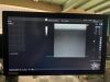 GE Logiq P9 Ultrasound - Shared Service