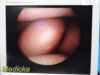 SMITH & NEPHEW 4131 Rigid Telescope | 2.7mm x 30° Arthroscope