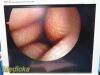 SMITH & NEPHEW 4131 Rigid Telescope | 2.7mm x 30° Arthroscope