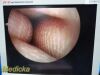 SMITH & NEPHEW 4131 Rigid Telescope | 2.7mm x 30° Arthroscope