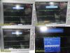 GE HEALTHCARE 2016 GE Mac 5500HD ECG Machine W/ CAM HD Module, IF Cable, Trolley & Bat.