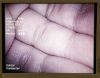 OLYMPUS WA50012A Laparoscope