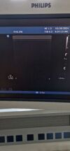 PHILIPS L12-3 Ultrasound Transducer