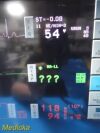 SPACELABS 91370 Ultraview SL Patient Monitor