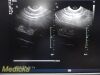 PHILIPS C8-4V Convex Array P/N 453561287502 Endocavity Ultrasound Transducer