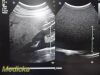 PHILIPS C5-1 Convex , (Ref 453561224465) *TESTED* ~ Ultrasound Transducer