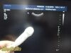 PHILIPS C8-5 Micro Convex Array Ultrasound Transducer