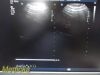 PHILIPS C8-5 Micro Convex Array Ultrasound Transducer