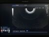OLYMPUS GF-UCT240 Endoscope