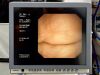 OLYMPUS GF-UCT240 Endoscope