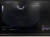 OLYMPUS GF-UCT240 Endoscope