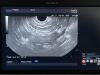 OLYMPUS GF-UCT240 Endoscope