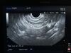 OLYMPUS GF-UCT240 Endoscope