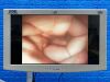 KARL STORZ 13905 PKS Colonoscope