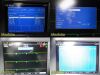GE HEALTHCARE 2016 GE Mac 5500 HD ECG Machine W/ CAM-HD Module, IF Cable,Trolley &Server
