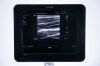 PHILIPS Sparq USG Machine