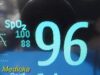 PHILIPS MP30 Anesthesia Patient Monitor