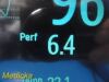 PHILIPS MP30 Anesthesia Patient Monitor