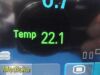 PHILIPS MP30 Anesthesia Patient Monitor