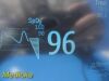 PHILIPS Intellivue MP50 Patient Monitor
