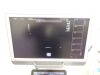 SIEMENS Acuson S1000 HELX Evolution Ultrasound - OB / GYN - Vascular