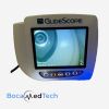 VERATHON 0570-0306 GlideScope AVL Monitor   Baton - 30 Day