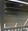 DATASCOPE Passport V Monitor