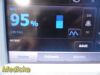 WELCH ALLYN 64MTXE / VSM 6000 Series Connex Patient Monitor