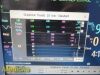PHILIPS Intellivue MP20, Ref M8001A W/ MMS Module, Leads & Antenna ~ Monitor