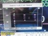 PHILIPS Intellivue MP30, W/ M3001A MMS Module & NEW Leads ~  Patient Monitor