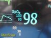 PHILIPS Intellivue MP20, Ref M8001A W/ MMS Module, Leads & Antenna ~ Monitor