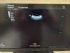 MINDRAY Consona N9 Ultrasound - OB / GYN - Vascular