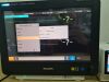 PHILIPS IntelliVue MX700 Patient Monitor + CO2 Module with Intellivue X3 867030 Monitor