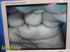KARL STORZ KarlStorz 8402X Electronic,W/ C-HUB, Camera HUB, PSU, Laryngoscope ~ Module