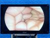 STRYKER 1688 4K Tower Laparoscope