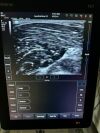 MINDRAY TE7 Vaginal And Linear Ultrasound - Vascular - Small Parts