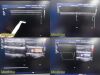 PHILIPS iU22 Diag Ultrasound W/ L17-5, L15-7io, C8-5 Probes &Foot Control