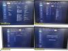 PHILIPS iU22 Diag Ultrasound W/ L17-5, L15-7io, C8-5 Probes &Foot Control