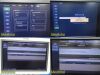PHILIPS iU22 Diag Ultrasound W/ L17-5, L15-7io, C8-5 Probes &Foot Control